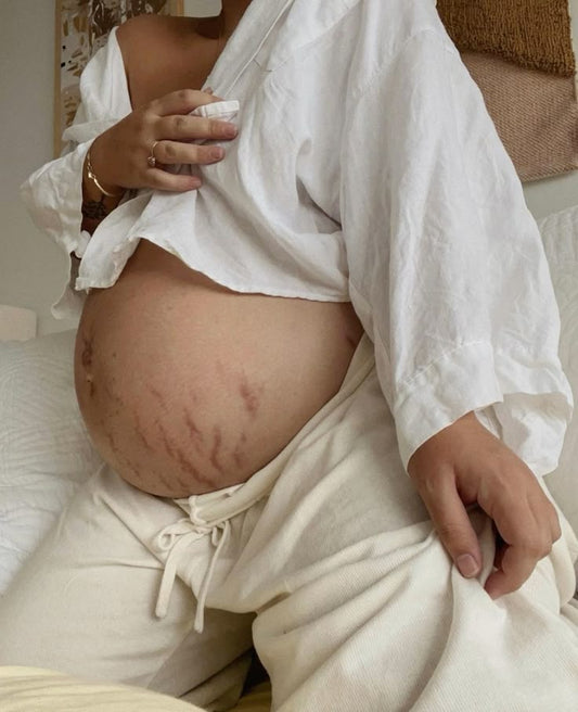 ACEPTAR LOS CAMBIOS DE TU CUERPO DURANTE EL EMBARAZO